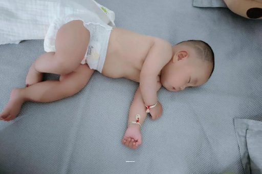 泰州宝宝上火有眼屎